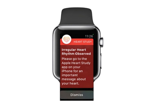 Apple Watch Heart Study